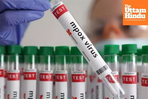Germany confirms first case of new mpox variant Germany confirms first case of new mpox variant