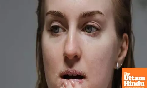 A world-first 3D cell model to boost treatments for lip injuries