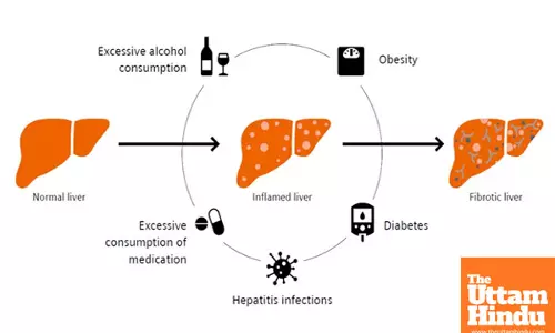 AI can detect early metabolic liver disease, Helping prevent severe liver damage