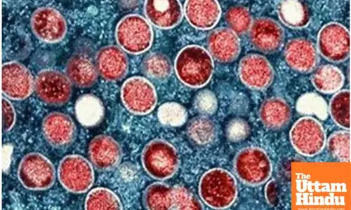 US confirms first case of clade I mpox in California