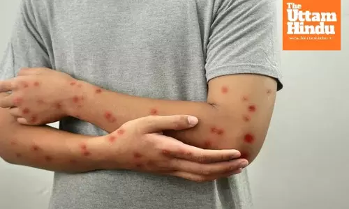 India’s New Twist in Monkeypox Detection