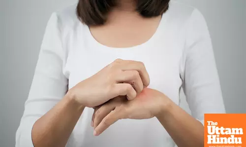 AI set to revolutionize atopic dermatitis diagnosis and care