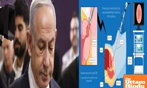 Israeli PM to undergo prostate removal surgery