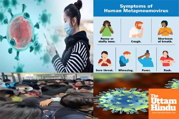 Experts say HMPV infection causes mild flu-like symptoms, no cause for alarm Experts say HMPV infection causes mild flu-like symptoms, no cause for alarm