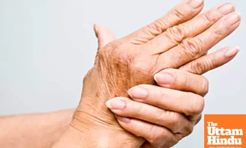 New AI method to pick up arthritis, lupus early in high-risk patients