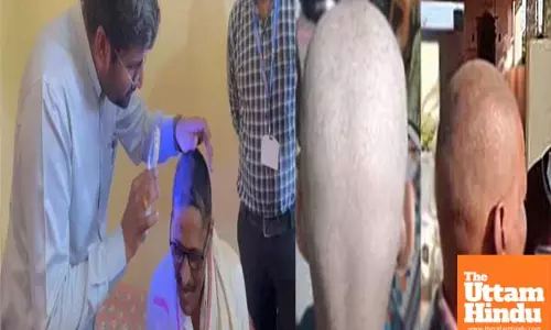 Balding bombshell: Maharashtra villages hit by mysterious hair loss epidemic!