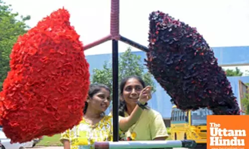 Women more likely than men to live for 5 years after lung transplant: Study