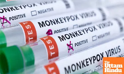 Mpox: Bengaluru reports 1st case of 2025 in 40-year-old man with travel history