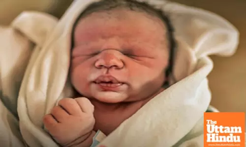 Medical leader urges caution amid reports of Indians seeking early C-Sections to beat Trump citizenship order