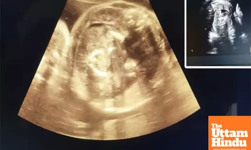 Doctors stunned as sonogram reveals baby inside another baby in pregnant woman’s stomach