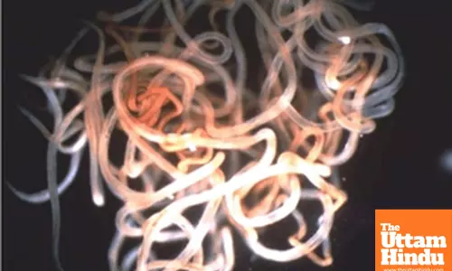 Niger becomes first African country to eliminate onchocerciasis