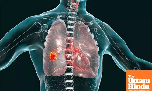 Air Pollution: A Rising cause of lung cancer among non-smokers