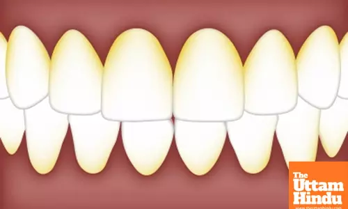 Breakthrough Study Shows Oral Bacteria as a Potential Early Warning for Alzheimer’