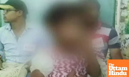 Shocking Cruelty: Mom Burns 4-Year-Olds Skin with Scorching Hot Tawa