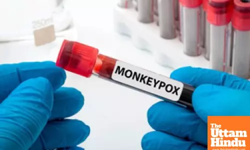 South Sudan declares mpox outbreak with first case confirmed