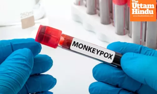 South Sudan declares mpox outbreak with first case confirmed