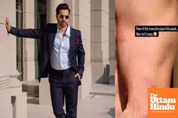 Varun Dhawan showcases ‘few of the many bruises’ he sustained Varun Dhawan showcases ‘few of the many bruises’ he sustained