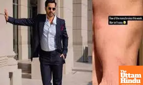 Varun Dhawan showcases ‘few of the many bruises’ he sustained