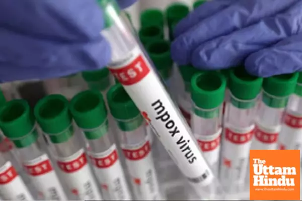 Kenyas monkey pox cases rise to 41