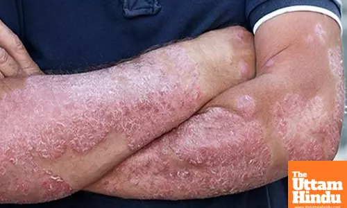 Combination immunotherapy may cure patients with deadly advanced skin cancer