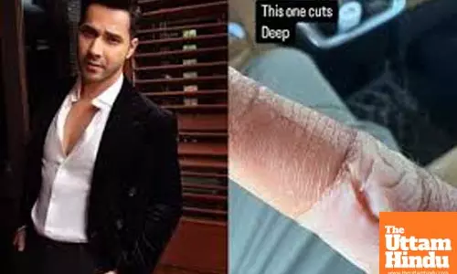 Varun Dhawan suffers injury, shows off deep cut on his finger