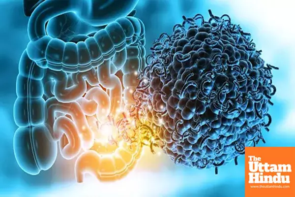 Study shows how gut microbiome raises risk of multiple sclerosis Study shows how gut microbiome raises risk of multiple sclerosis