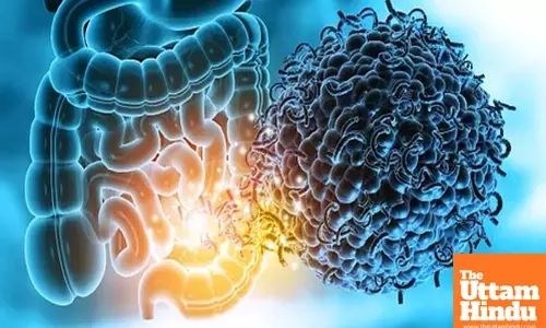 Study shows how gut microbiome raises risk of multiple sclerosis