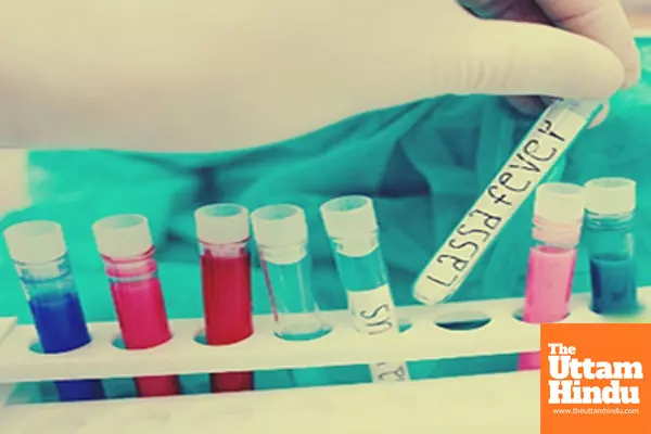 Lassa Fever Outbreak in Nigeria Claims 80 Lives Lassa Fever Outbreak in Nigeria Claims 80 Lives