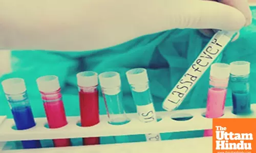 Lassa Fever Outbreak in Nigeria Claims 80 Lives