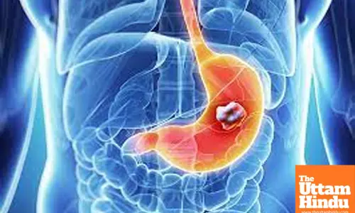 Study Finds Link Between Gastric Bacteria and Stomach Cancer Development