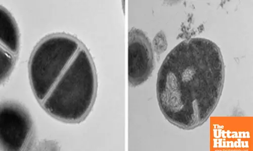 Human bodys protein recycling system fights bacteria like antibiotics: Study