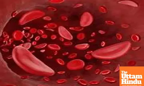 Rising Lifestyle Disorders Among Women in India: Study Finds Three in Five Women at Risk of Anaemia