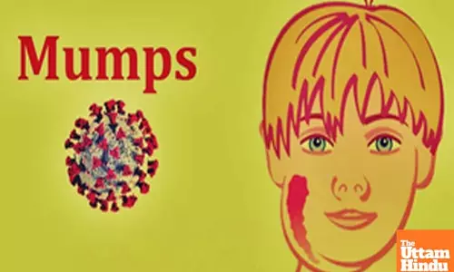 TN issues high alert as mumps spread among schoolchildren in Coimbatore