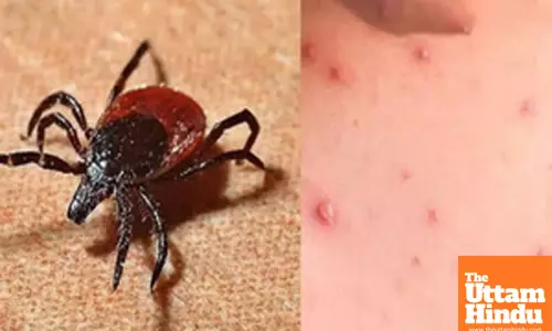 Rural communities at high risk of scrub typhus infections: Study