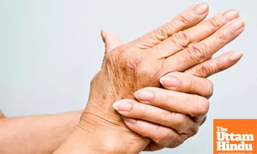 Chinese scientists develop novel hydrogel to combat rheumatoid arthritis