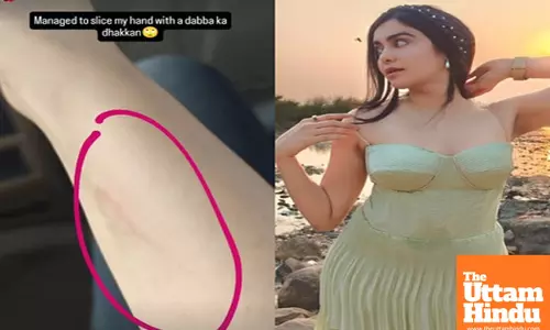 Adah Sharma hilariously ‘sliced’ her hand with ‘dabba ka dhakkan’