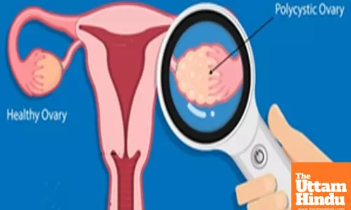 US researchers decode origins of ovarian cancer