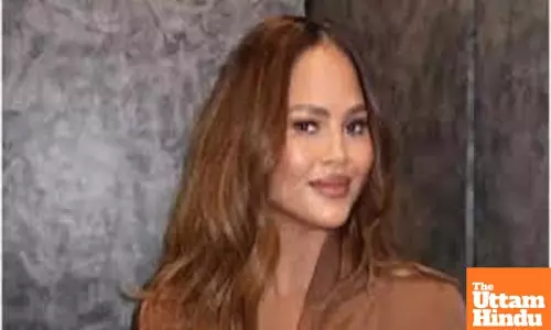 Why Chrissy Teigen says she’s gonna have the ‘worst black eye’?