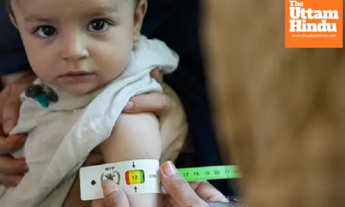 WFP warns of malnutrition threats in Afghanistan, 3.5 million children at risk in 2025