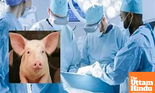 A New Era in Organ Transplantation: Chinese Doctors Perform First Pig Liver Transplant into Human