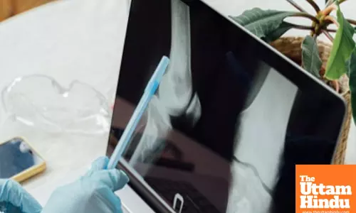 NIT Rourkela’s natural bioink to help 3D bioprinting of bone tissue