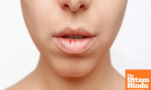 Lip Cancer: Early Signs, Causes, and Prevention Tips You Need to Know