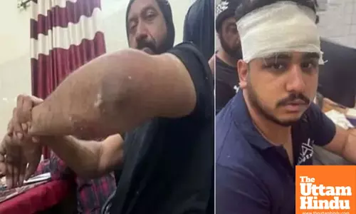 Colonel Bath Assault Case: SIT Launches Investigation, Issues Helpline Number for Witnesses