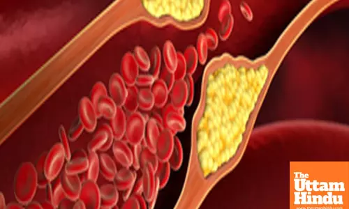 Reduce your bad cholesterol levels to keep Alzheimer’s, dementia at bay