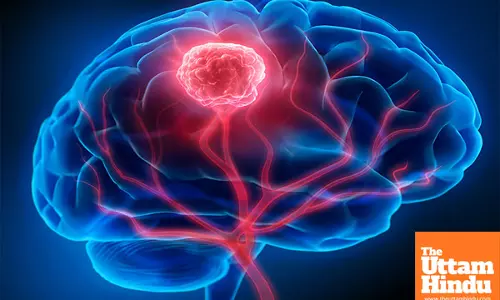 Shocking Coincidence :10 Nurses Diagnosed with Brain Tumors on the Same Hospital Floor, Doctors Express Concern