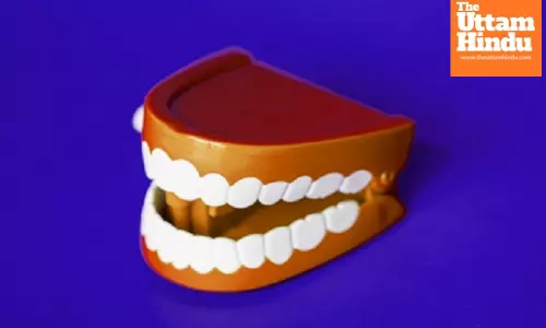 Could Your Migraine Be Coming From Your Teeth? Shocking New Study Reveals Alarming Connection