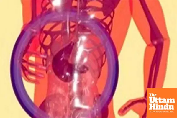 Fatty liver in pregnancy may increase risk of preterm birth Fatty liver in pregnancy may increase risk of preterm birth