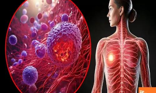 NIT Rourkelas new biosensor offers affordable breast cancer diagnosis NIT Rourkelas new biosensor offers affordable breast cancer diagnosis