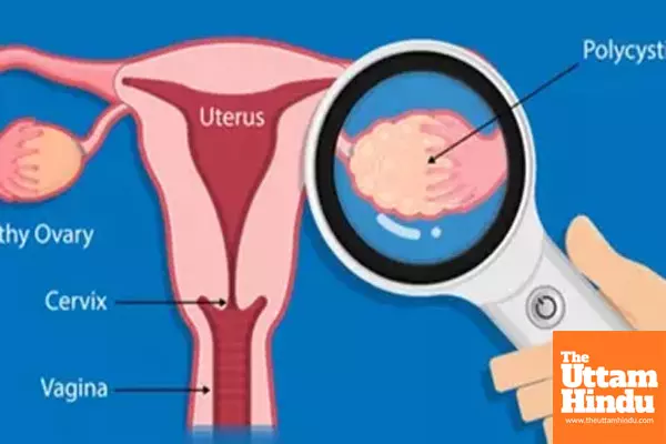 Women with PCOS likely to have attention, cognitive issues: Study