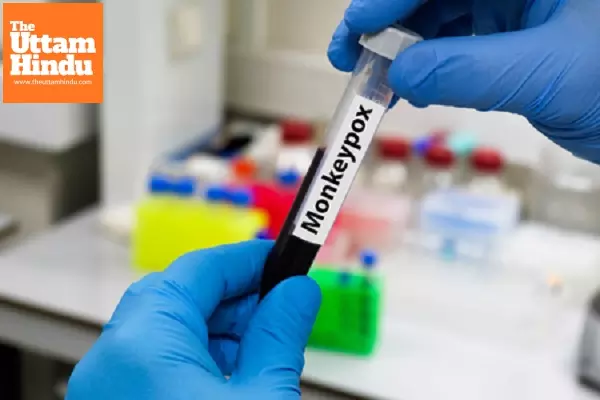 Africa CDC urges aggressive action to curb mpox outbreak in southern Ethiopia